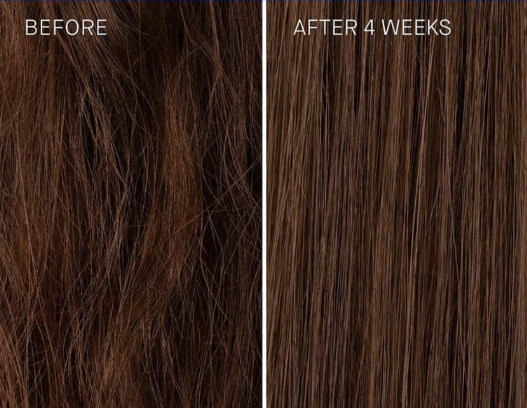 Hair Growth Bundle | Skin Rejuvenation Kit | Rosemary Argan Oil Set