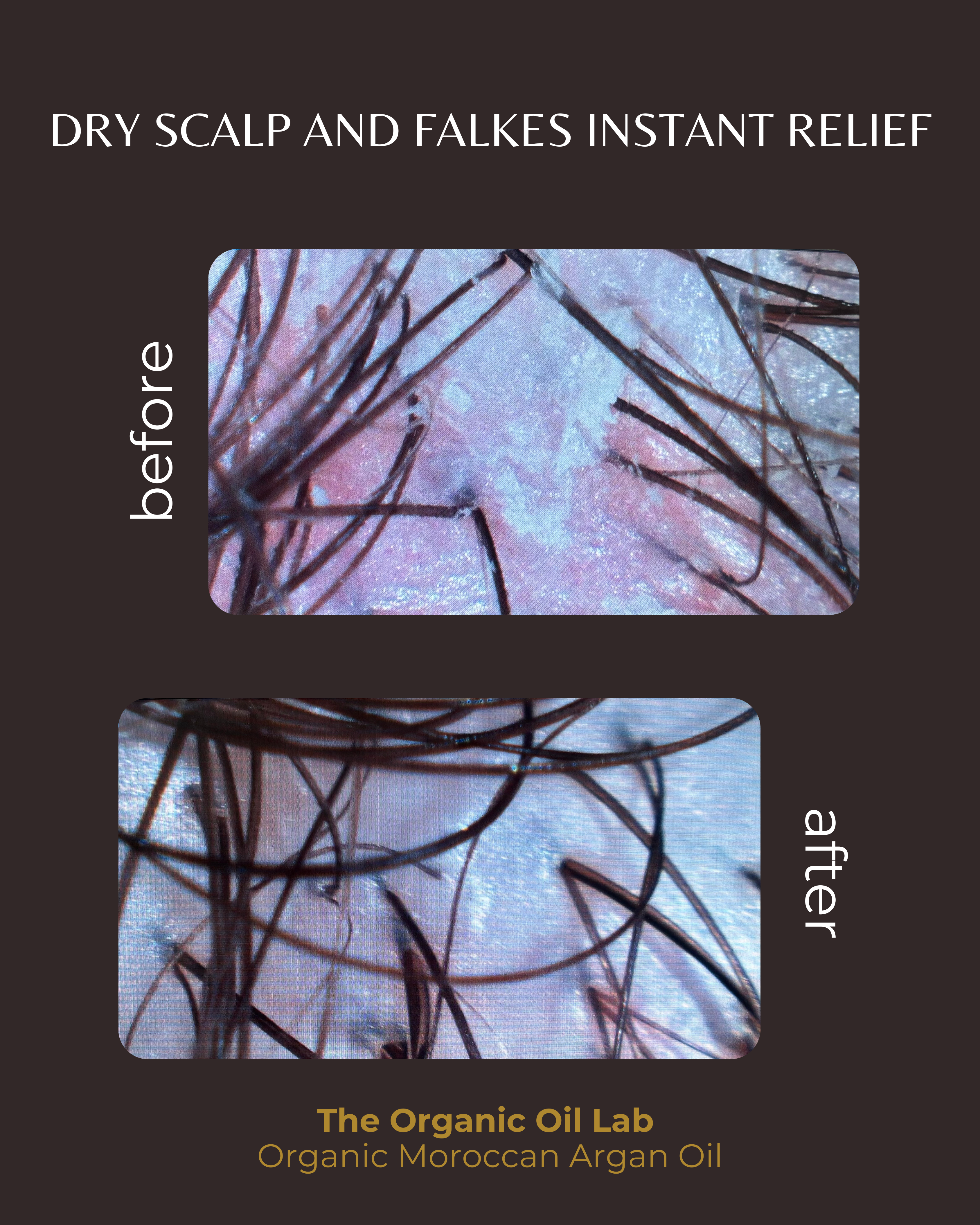 Hair Growth Bundle | Skin Rejuvenation Kit | Rosemary Argan Oil Set