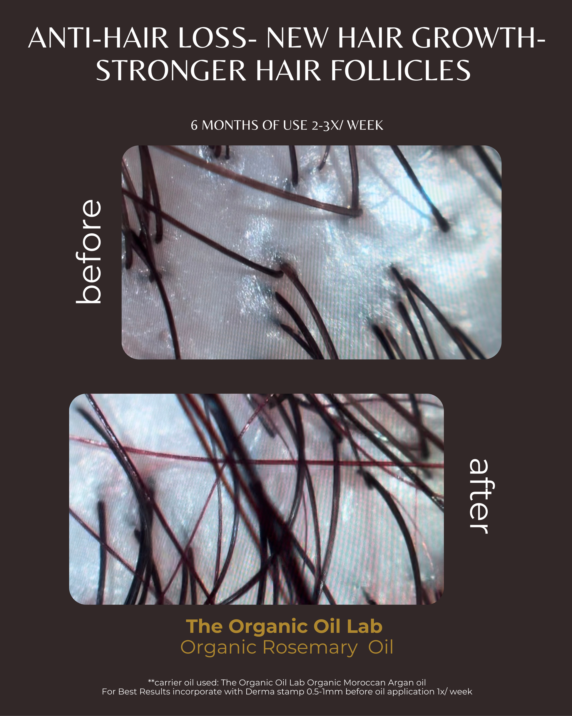 Organic Rosemary Oil | USDA Organic Essential Oil for Hair