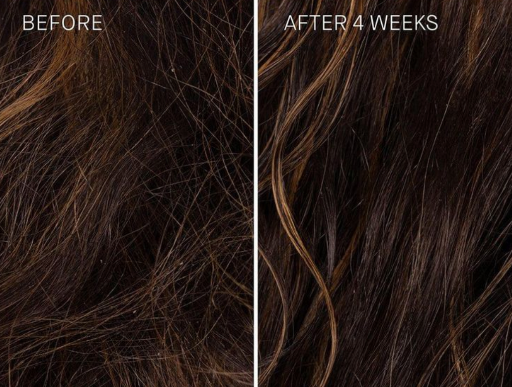 Ultimate Hair Growth & Anti Hairloss Bundle