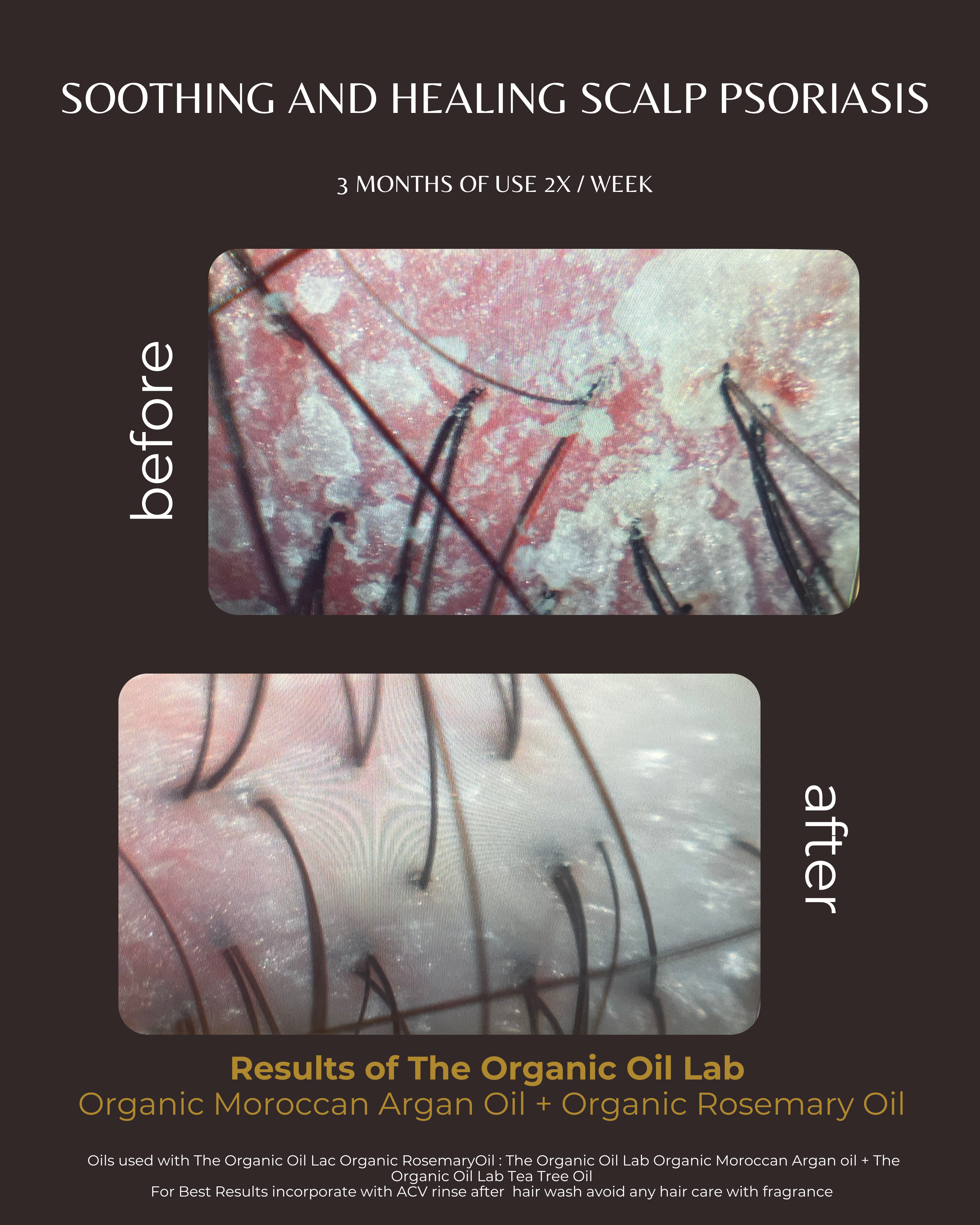 100% Organic Rosemary Essential Oil for Hair Growth & Focus | The Organic Oil Lab